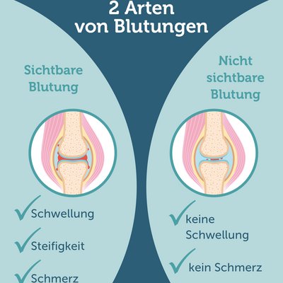 Mikroblutungen.jpg Mikroblutungen.jpg
